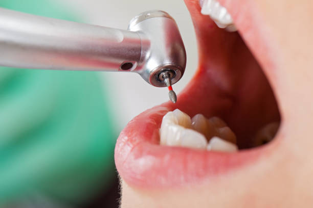 Best Urgent Care for Lost Fillings or Crowns in Inverness, CO